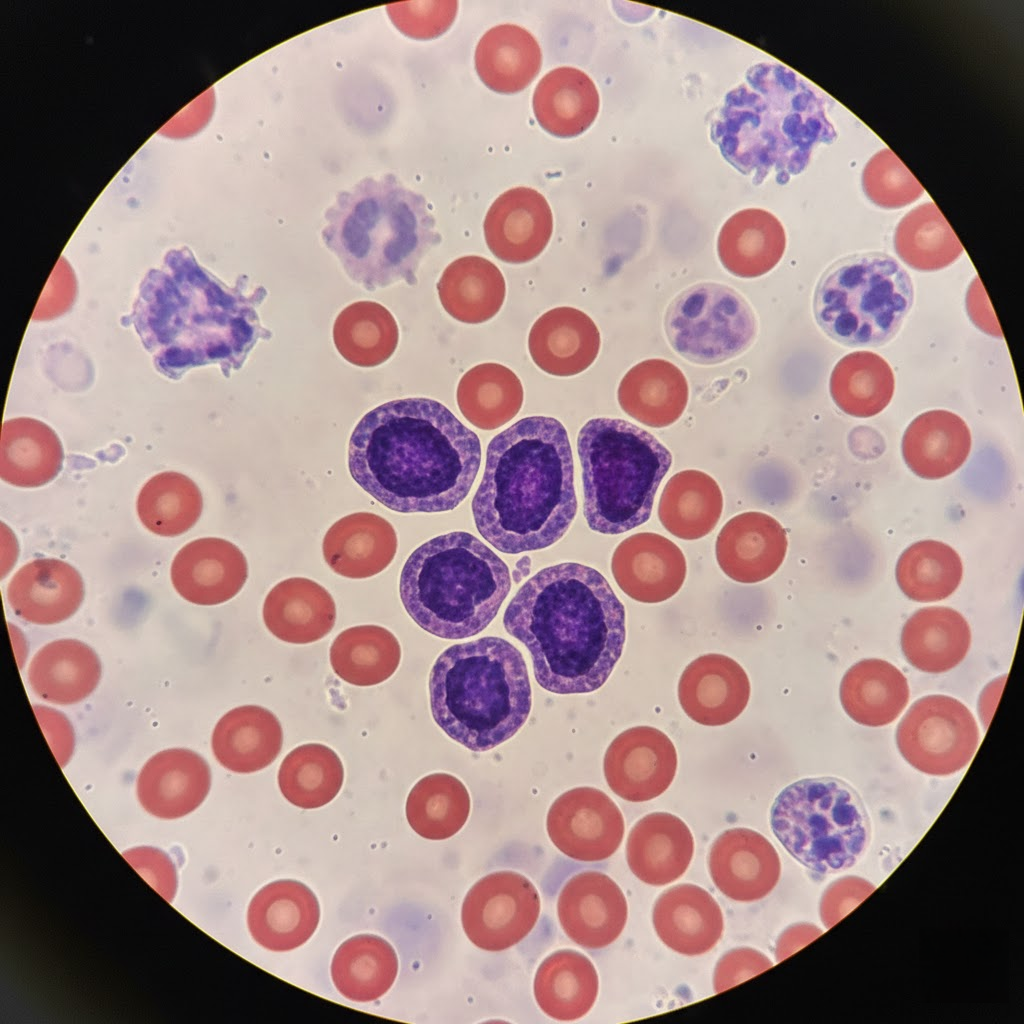 Bazofilai: Kodėl šie kraujo „mažyliai“ sukelia audras jūsų organizme?